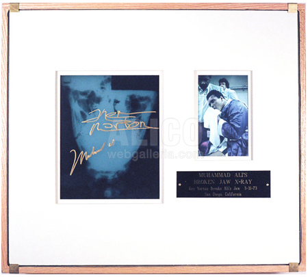Muhammad Ali Autographed X-ray Shadowbox with Photo from the 