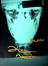 Broken jaw X-ray. Autographed by Ali and Norton